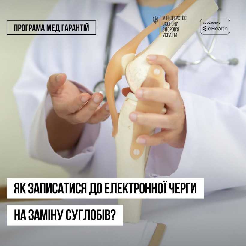В Україні працює електронна черга на безоплатне ендопротезування